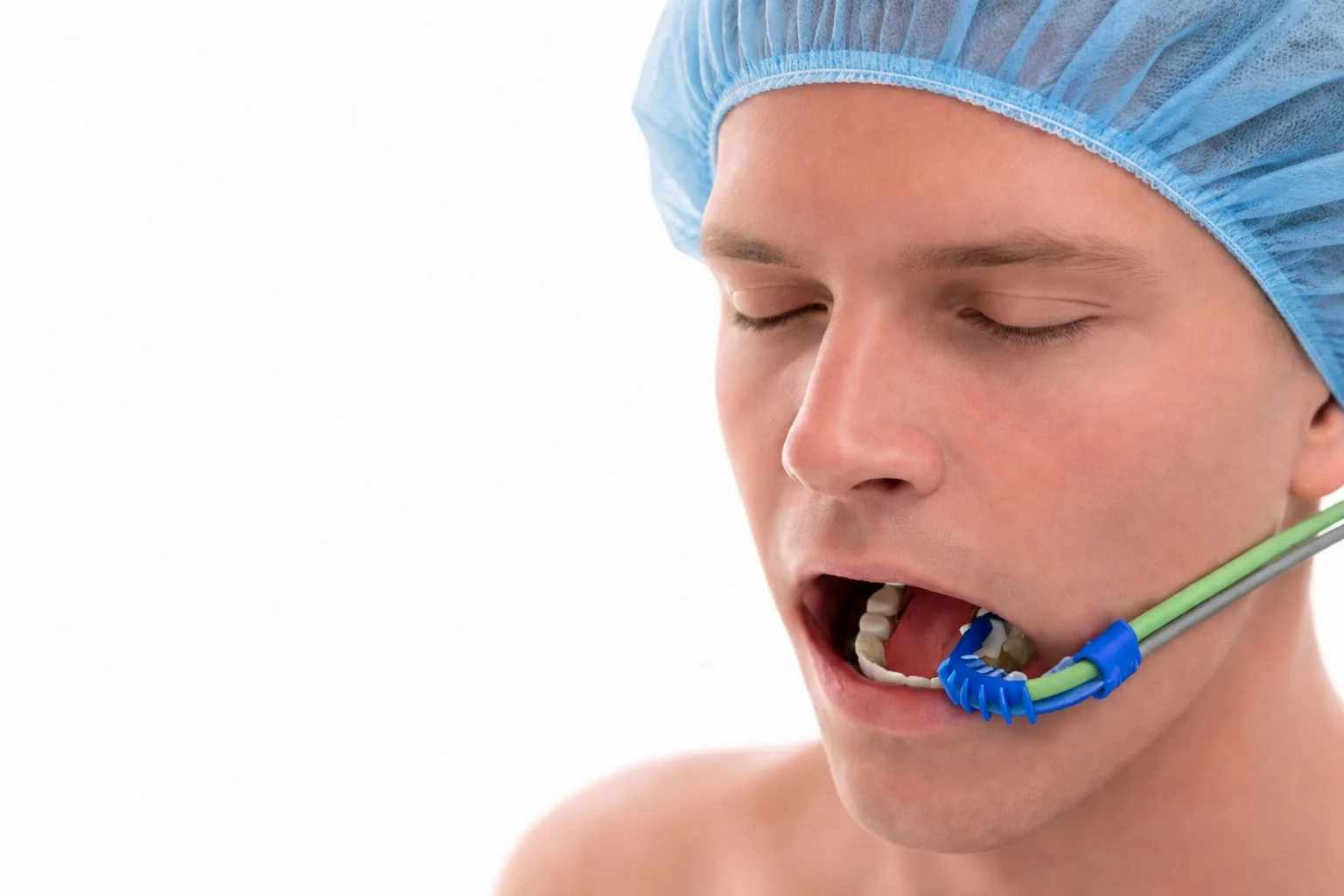 AIM intraoral bite block in place in a sedated patient's mouth, delivering pharyngeal oxygen